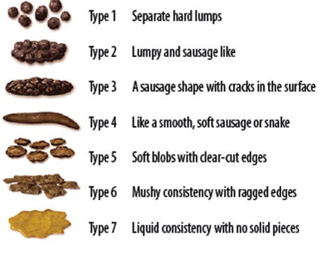 Bristol Stool Chart